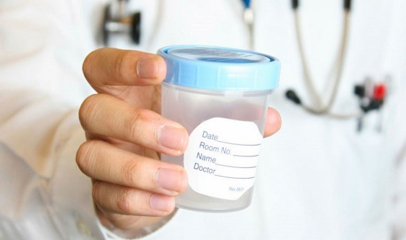 Sperm testi (Spermiogram) nedir? Sperm testi nasıl yapılır?