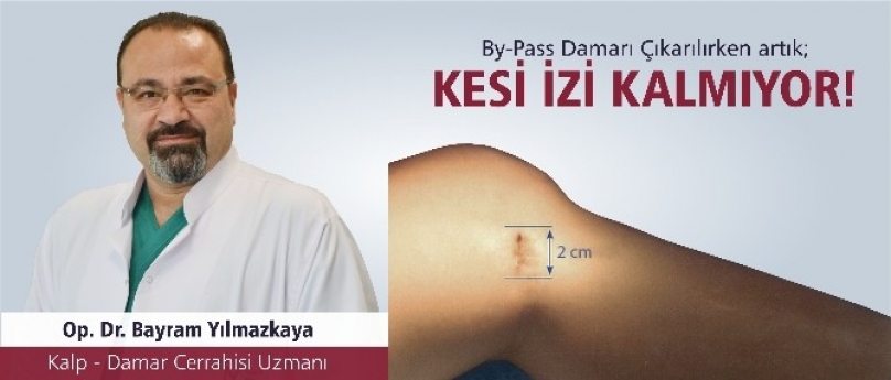 By-pass sırasında artık kesi izi kalmıyor