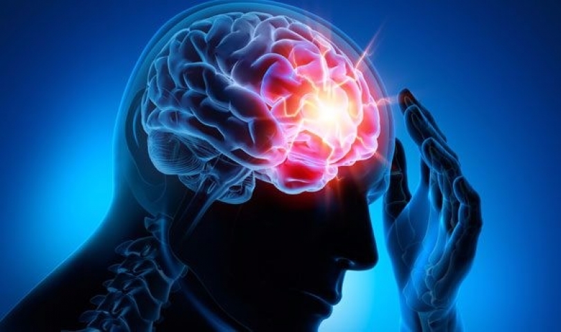 Epilepsi İle İlgili Bilmeniz Gereken 10 Gerçek