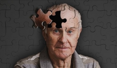 Alzheimer hastalığından nasıl korunmalıyız?