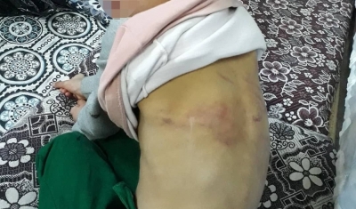 Çocuğuna işkence yapan Suriyeli baba tutuklandı